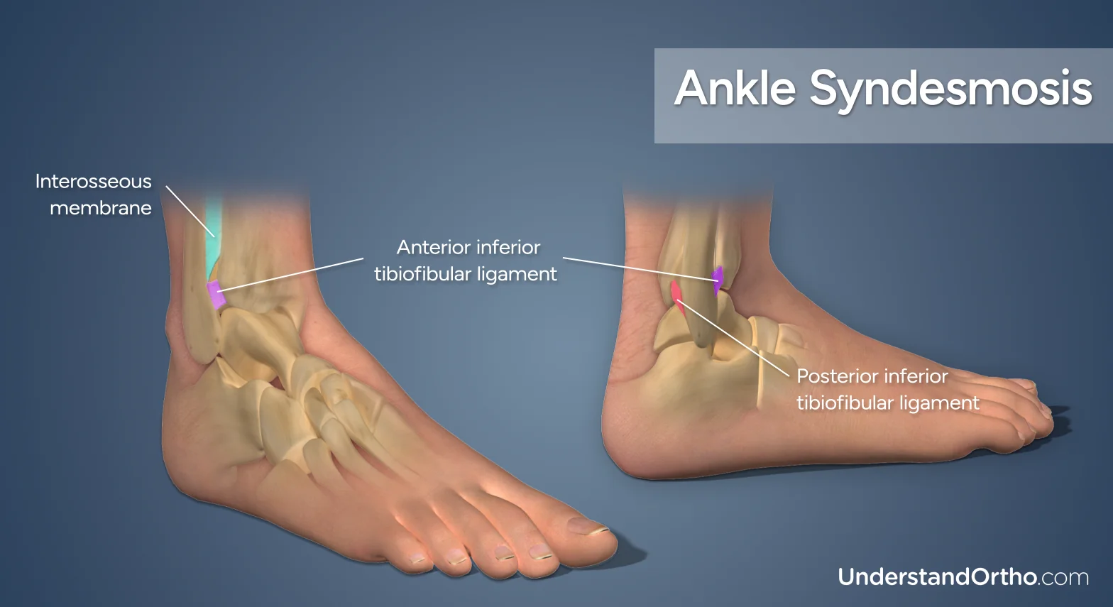 High Ankle Sprain Anatomy Physiotherapy Phnom Penh HIGH ANKLE SPRAIN High Ankle Sprain Anatomy Physiotherapy Phnom Penh HIGH ANKLE SPRAIN