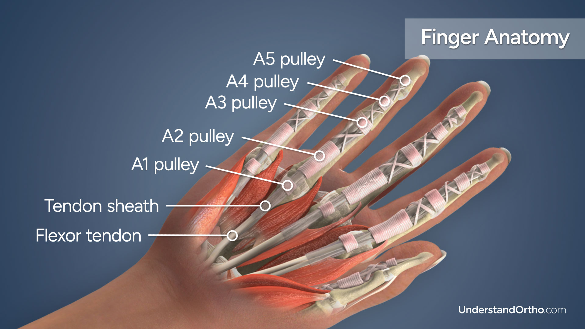 Anatomy Of Trigger Finger Digital Tendon Entrapment