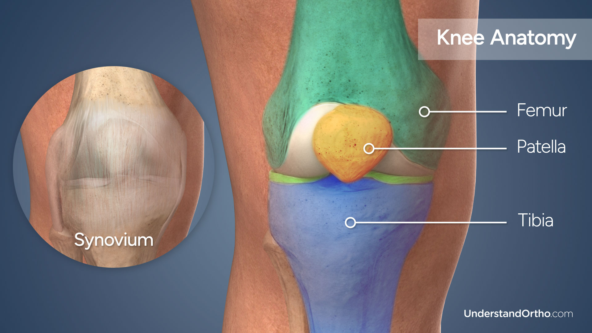 3D rendering of the knee with colored regions highlighting the Femur, Patella, Tibia, and Synovium