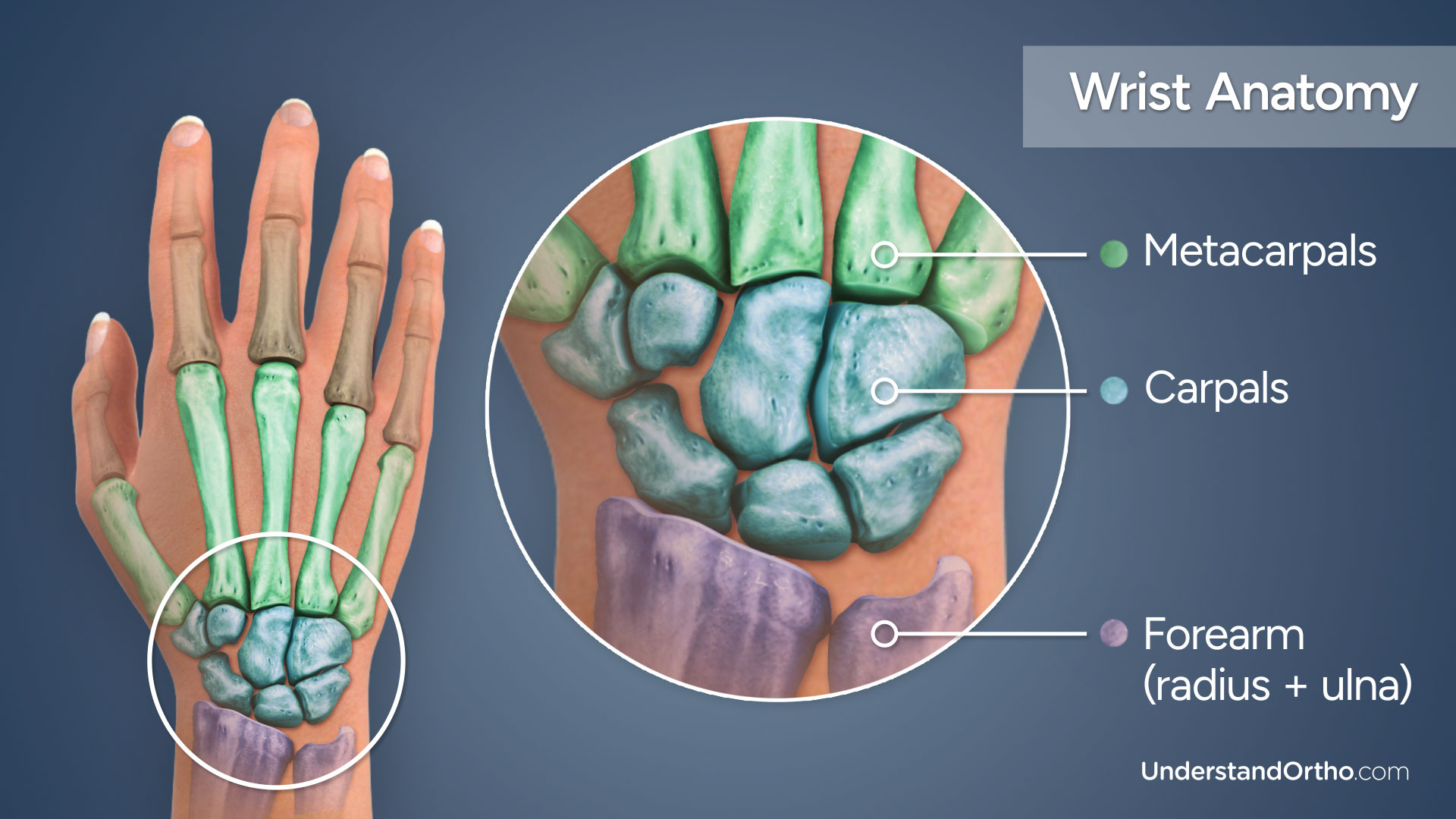 3D rendering of the hand prominently displaying its bones with a focus on the Metacarpals and Carpals (otherwise known as the wrist bones)